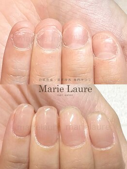マリーロール 天王寺店(Marie Laure)/自爪育成/深爪矯正/ネイルケア