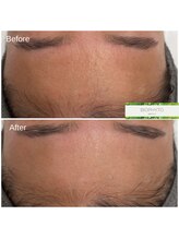 クレア(Clair)/ビオフィート症例