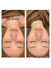 スリーズララ 大船駅前店(Cerise LaLa)/◆肌の土台から美しく◆