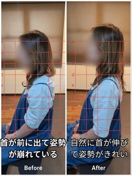 リバース(Re:Birth)/「前に出た首がスッと伸びる」