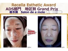 サロンドアモール(Salon de a mole)の雰囲気（ノーファンデーションが叶う！何をしても結果が出なかった方へ）