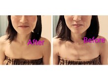 メグリ(めぐRe.)/黄金比フェイシャル60分