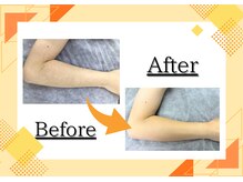 アルゴ 西鉄香椎駅前店(ALGO)/スクラブでツルスベ肌