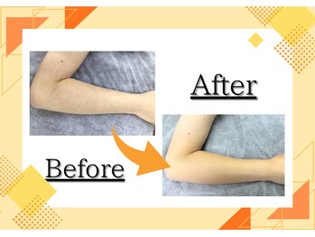 アルゴ 西鉄香椎駅前店(ALGO)/スクラブでツルスベ肌