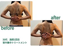 ミラリ(mirari)の雰囲気（左before：右after）