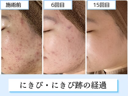 モビー 天王寺店(mobee)の写真