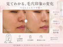 ラシック(La chic)の雰囲気(クリスティーナ/ハーブピーリング×毛穴洗浄で毛穴悩みを解決◎)