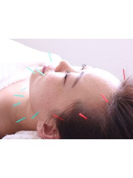 小顔になりたい