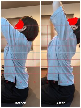 リバース(Re:Birth)/1回でも動きが改善。