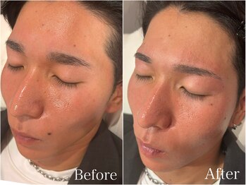 ジョエルワックス 沖縄那覇店(JOELLE WAX)/新規メンズ★眉ワックス