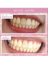 エクシアホワイト 長野店/