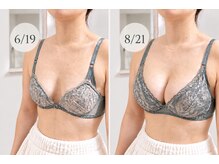 ベッピン(Beppin)の雰囲気（回数を重ねるごとに、自然な丸みのある美しいバストへ）