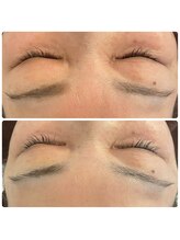 ル シェリア(Le Cherien)/贅沢エイジングケアコース♪