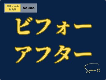 ソウノ 御茶ノ水(Souno)/ビフォーアフター
