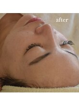 ココルーネ(COCORUNE)/シルク肌ハーブピーリング