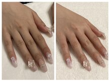 キレイテ 福岡天神店/20代のお客様