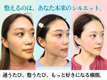 ナチュラルビューティーフェイス 横浜(NBF)/あご・口角バランス矯正