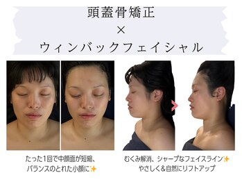五感プラス(五感Plus)/頭蓋骨矯正×ウィンバック小顔