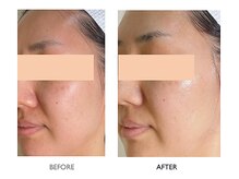 サロンドオフ 御堂筋店(salon de off)/