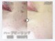 エーアール(ar)の写真