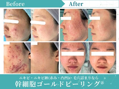 リメイク 広尾(REMAKE)の写真