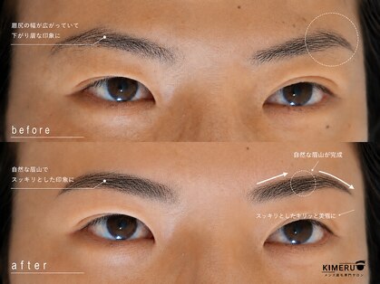 キメル(KIMERU)の写真