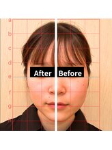 美バリ 新宿店(美BARI)/エクソソーム/NMN/幹細胞導入