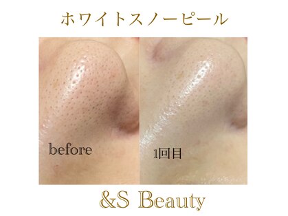 アンドエスビューティ(&S Beauty)の写真