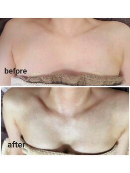 イベリス(IBERIS.)/当店ビフォーアフター