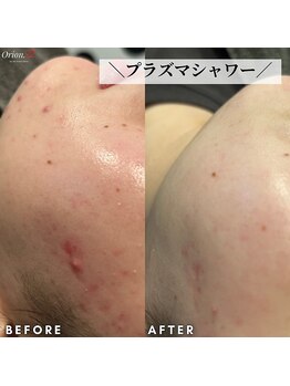 オリオンドットエスツー(Orion.S2)/【Before→After】