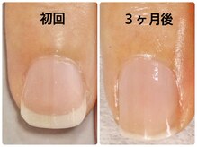 ネイルサロンエマ(EMA)の雰囲気（貝爪、小さい爪の方でも3か月でこんなに縦長の美爪に！）