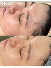 スリリアン 銀座/★お客さまビフォーアフター★