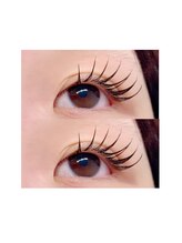 ブライズ(BRISE)/バインドロック