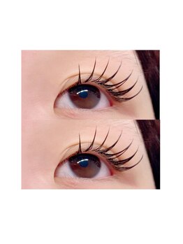 ブライズ(BRISE)/バインドロック