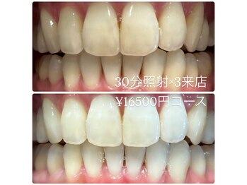 ホワイトニングルーム 川崎店(WhiteningRoom)/ホワイトニング/川崎