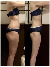 リアン(Liens)/美脚ケア