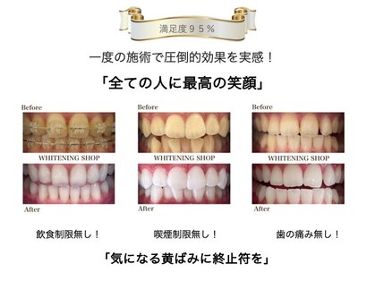 ホワイトニングショップ 焼津店の写真