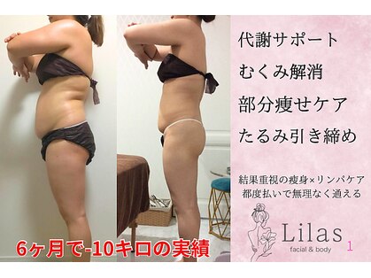 リラ(Lilas)の写真