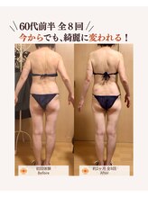 ユナリ(yunari)/60代前半｜Before・Afte