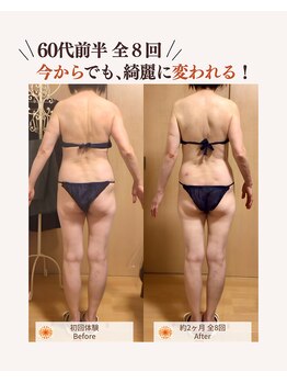 ユナリ(yunari)/60代前半｜Before・Afte