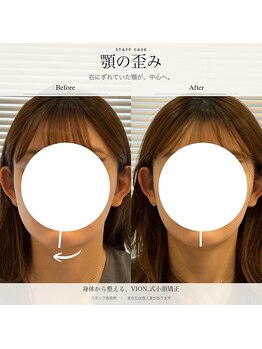 ヴィオン整体院(VION.整体院)の写真/気になる部位に根本アプローチ！フェイスラインやたるみを整える特別体験！先着８名限定クーポン[小顔整体]
