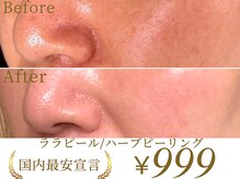 南青山コスメクリニック スキンラボ 横浜(SKIN LAB)