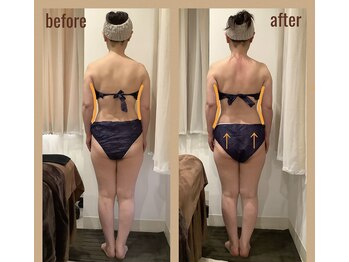 レアフィート(Rheafeet)/症例写真です。