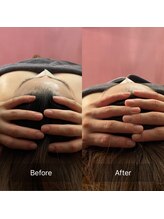 ハートランド(HEARTLAND)/小顔・むくみ改善　1回の施術