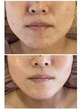 ロッシュ フェイス(Roche Face)/30代女性