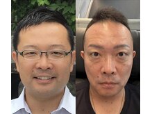 ランスソア(L'ins soi)/