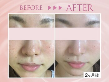 クリアラボ 川崎(Clear Lab)/韓国式肌管理&毛穴洗浄専門店