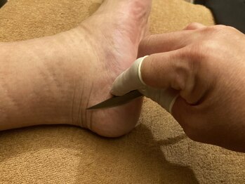 角質フットケアサロン リラックスパーク 大阪難波店(RelaxPark)/台湾式角質取り角質除去角質ケア