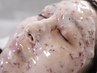 【一発でお肌艶々モチモチ】Facewax+ハイドロジェリーマスク ¥12000