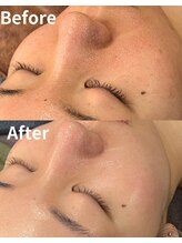 スリリアン 銀座/★お客さまビフォーアフター★